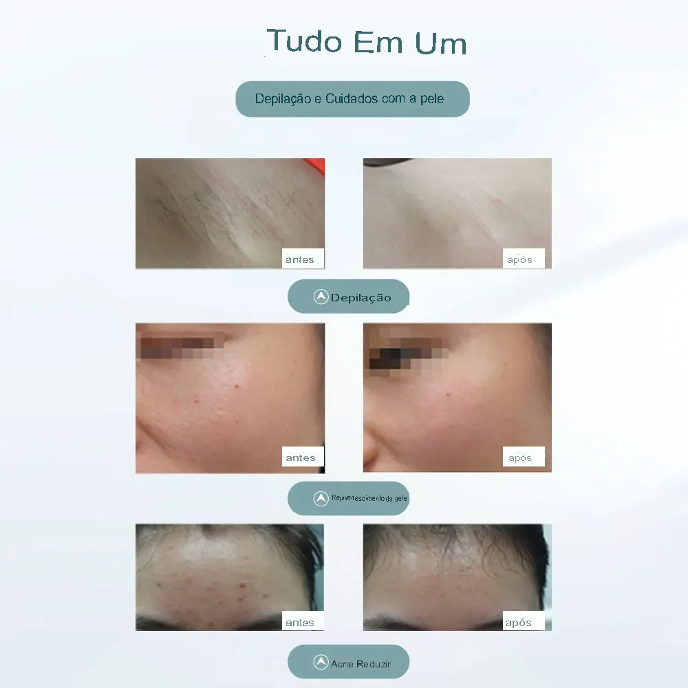 Depilador Laser Permanente SkinLaser Pro
