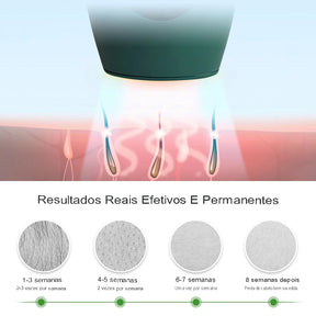 Depilador Laser Permanente SkinLaser Pro