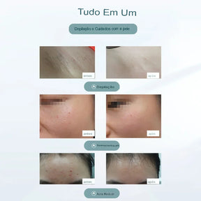 Depilador Laser Permanente SkinLaser Pro